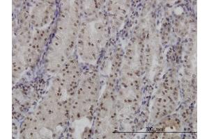 Immunoperoxidase of monoclonal antibody to FOXO3A on formalin-fixed paraffin-embedded human stomach.
