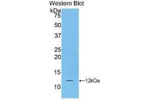 Western blot analysis of recombinant Human S100A5. (S100A5 anticorps  (AA 1-92))