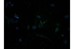 Immunofluorescence staining of HepG2 cells with ABIN7140161 at 1:100, counter-stained with DAPI. (TAS2R5 anticorps  (AA 149-164))