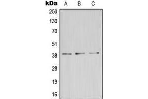 Western blot analysis of ZDHHC9 expression in HeLa (A), mouse kidney (B), rat brain (C) whole cell lysates. (ZDHHC9 anticorps  (C-Term))