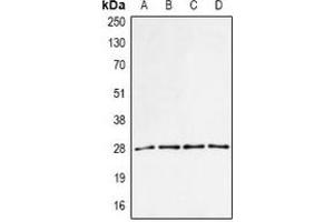 Western blot analysis of PA28 alpha expression in MCF7 (A), BT474 (B), mouse spleen (C), mouse liver (D) whole cell lysates. (PSME1 anticorps)