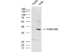 Lane 1: Mouse testis lysates, Lane 2: Hela lysates probed with FAM134B Polyclonal Antibody, Unconjugated  at 1:300 overnight at 4˚C. (FAM134B anticorps  (AA 210-310))