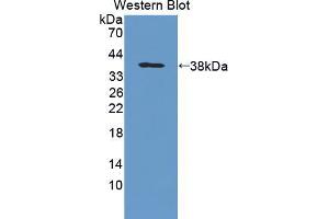 Western blot analysis of the recombinant protein. (PTPRG anticorps  (AA 848-1119))