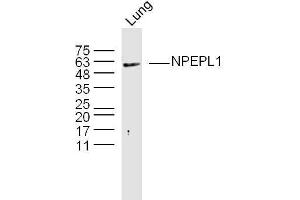 Mouse lung lysates probed with NPEPL1 Polyclonal Antibody, Unconjugated  at 1:300 overnight at 4˚C. (NPEPL1 anticorps  (AA 371-470))