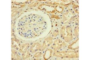 Immunohistochemistry of paraffin-embedded human kidney tissue using ABIN7176159 at dilution of 1:100 (ZNF221 anticorps  (AA 1-300))