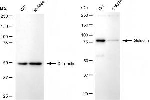 Western blotting analysis using gelsolin antibody (ABIN7798702).