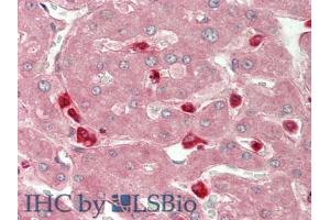 IHC-P analysis of Human Liver Tissue, with HE staining. (CHI3L1 anticorps  (AA 112-377))