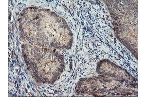 Image no. 4 for anti-SUMO1/sentrin/SMT3 Specific Peptidase 2 (SENP2) (AA 139-523) antibody (ABIN1490927)