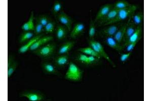 Immunofluorescence staining of HepG2 cells with ABIN7144729 at 1:166, counter-stained with DAPI.