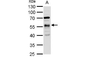 WB Image alpha Tubulin 1A antibody detects alpha Tubulin 1A protein by western blot analysis.