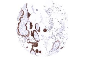 Strong papp A immunostaining of trophoblast cells of a first trimenon placenta