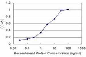 Detection limit for recombinant GST tagged RCV1 is approximately 0. (Recoverin anticorps  (AA 101-199))