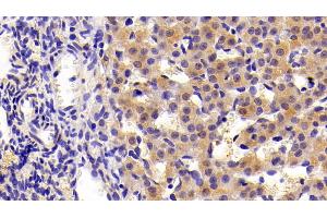 Detection of CK7 in Rat Ovary Tissue using Polyclonal Antibody to Cytokeratin 7 (CK7)