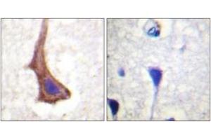 Immunohistochemistry analysis of paraffin-embedded human brain tissue, using CSFR (Ab-561) Antibody. (CSF1R anticorps  (AA 531-580))