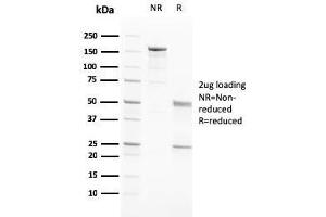 SDS-PAGE Analysis Purified PAPP-A Mouse Monoclonal Antibody (PAPPA/2717). (PAPPA anticorps  (AA 351-523))