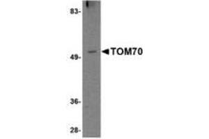 Image no. 1 for anti-Translocase of Outer Mitochondrial Membrane 70 (TOMM70A) (N-Term) antibody (ABIN341709) (TOM70 anticorps  (N-Term))