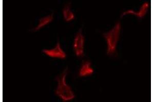 ABIN6278598 staining Hela by IF/ICC. (NOX1 anticorps  (C-Term))