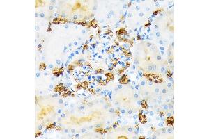 Immunohistochemistry of paraffin-embedded red blood cell staining in rat kidney using Hemoglobin subunit alpha (HB) (HB) Rabbit mAb (ABIN7267608) at dilution of 1:100 (40x lens).