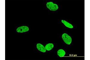 Immunofluorescence of monoclonal antibody to RUNX2 on U-2 OS cell. (RUNX2 anticorps  (AA 251-350))