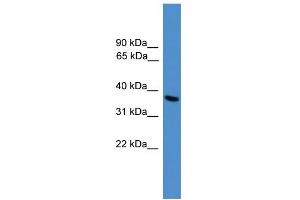 WB Suggested Anti-UCHL5 Antibody Titration: 0.