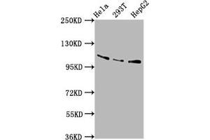 Western Blot Positive WB detected in: Hela whole cell lysate, 293T whole cell lysate, HepG2 whole cell lysate All lanes: AASS antibody at 5. (AASS anticorps  (AA 224-364))