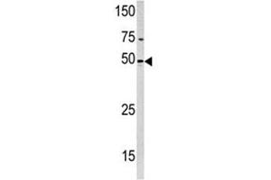 Western blot analysis of PXK antibody and HeLa lysate