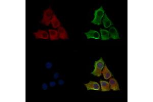 Phospho-ILK (Thr173) Antibody staining HepG2 cells(serum starvation treatment) by IF/ICC.
