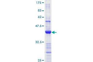 Image no. 1 for MutL Homolog 1 (MLH1) (AA 647-756) protein (GST tag) (ABIN1311006) (MLH1 Protein (AA 647-756) (GST tag))