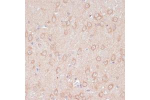 Immunohistochemistry of paraffin-embedded rat brain using D antibody (ABIN7265495) at dilution of 1:100 (40x lens). (ARL4D anticorps  (AA 92-201))