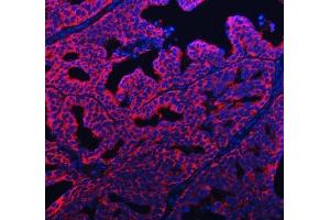 anti-Poly(A) Binding Protein, Cytoplasmic 4 (Inducible Form) (PABPC4) (Middle Region) antibody