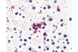 Image no. 1 for anti-Chemokine (C-C Motif) Receptor 4 (CCR4) (C-Term) antibody (ABIN488046) (CCR4 anticorps  (C-Term))