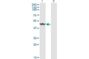 Western Blot analysis of SDCBP expression in transfected 293T cell line by SDCBP monoclonal antibody (M01), clone 2C12.
