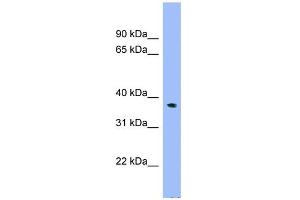 WB Suggested Anti-C17orf48 Antibody Titration: 0. (ADPRM anticorps  (N-Term))