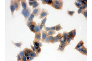 IHC analysis of FASN using anti-FASN antibody .