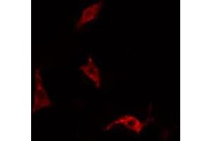 ABIN6266468 staining HepG2 cells by IF/ICC. (EPS15 anticorps  (pTyr849))