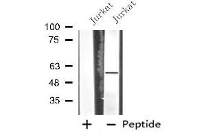 Western blot analysis of extracts from Jurkat cells, using MATK antibody. (MATK anticorps  (Internal Region))