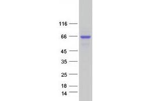 Validation with Western Blot