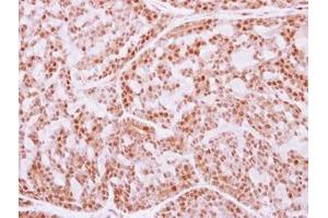 Image no. 1 for anti-Fanconi Anemia, Complementation Group E (FANCE) (AA 205-482) antibody (ABIN1498219)