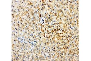 IHC-P: Tec antibody testing of rat liver tissue (NR4A3 anticorps  (AA 612-631))