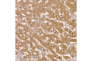 Immunohistochemistry of paraffin-embedded human liver using NUMB Rabbit pAb (ABIN6129424, ABIN6144943, ABIN6144944 and ABIN6224990) at dilution of 1:150 (40x lens).