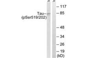 Western blot analysis of extracts from Jurkat cells treated with H2O2 100uM 30', using Tau (Phospho-Ser519/202) Antibody. (tau anticorps  (pSer519))