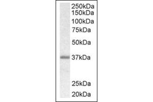 Image no. 1 for anti-Biglycan (BGN) (C-Term) antibody (ABIN375174)