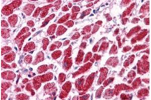 Human Heart: Formalin-Fixed, Paraffin-Embedded (FFPE)