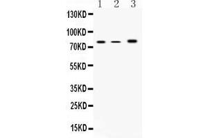 Western blot analysis of 12 Lipoxygenase using anti-12 Lipoxygenase antibody . (ALOX12 anticorps  (N-Term))