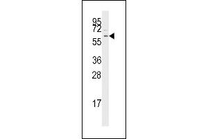 Western blot analysis of anti-TGFBR1 Pab (ABIN392279 and ABIN2841947) in Jurkat cell line lysates (35 μg/lane).