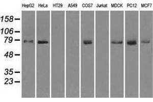 Western blot analysis of extracts (35 µg) from 9 different cell lines by using anti-FERMT2 monoclonal antibody. (FERMT2 anticorps)