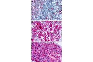 Immunohistochemical staining of formalin-fixed paraffin-embedded human tonsil (A), adrenal gland (B) and testis (C) with CELSR1 polyclonal antibody . (CELSR1 anticorps  (C-Term))