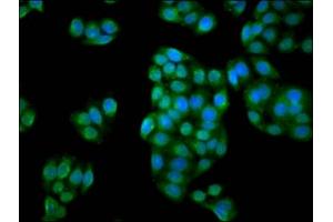 Immunofluorescence staining of PC-3 cells with ABIN7166787 at 1:133, counter-stained with DAPI.