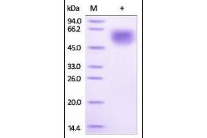Human IL-1RL1, His Tag on SDS-PAGE under reducing (R) condition.