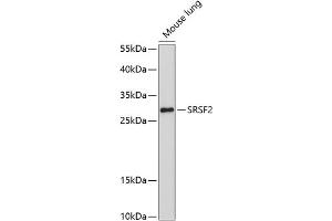 Western blot analysis of extracts of mouse lung, using SRSF2 antibody (ABIN1682677, ABIN3017915, ABIN3017916, ABIN5664377 and ABIN6220303) at 1:1000 dilution. (SRSF2 anticorps  (AA 1-75))